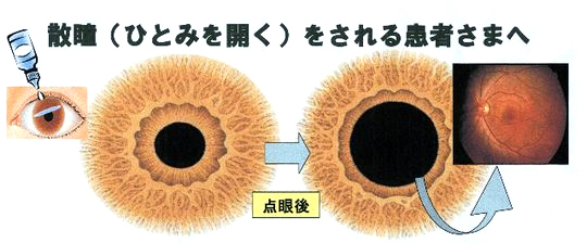 4.精密眼底検査（散瞳検査）が必要な患者様