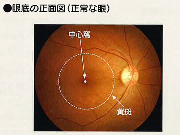 黄斑（おうはん）、中心窩（ちゅうしんか）とは