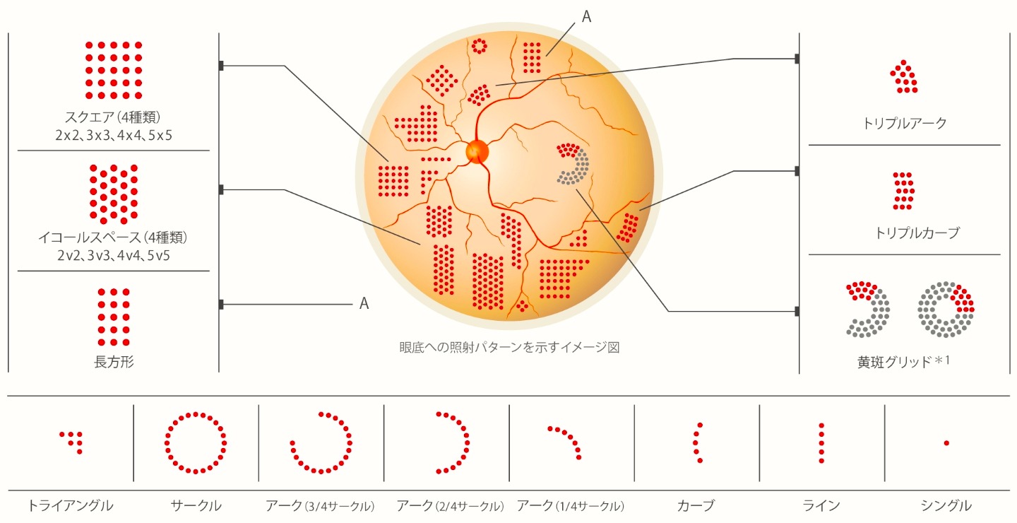 レーザー眼科治療