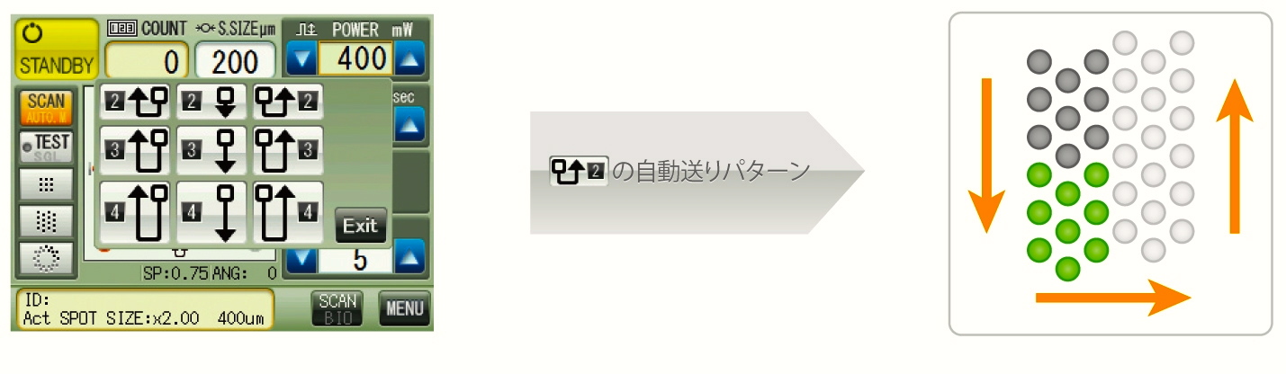 パターンスキャンレーザー