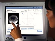 自動瞳孔追尾機能による高速処理